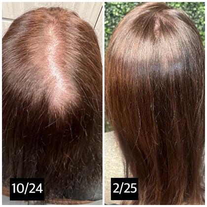 Hair-A-Dote Treatment