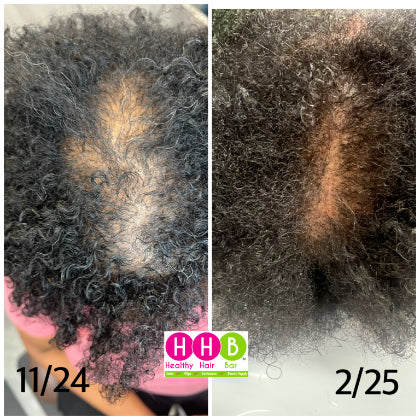 Organic Scalp Facial Treatment